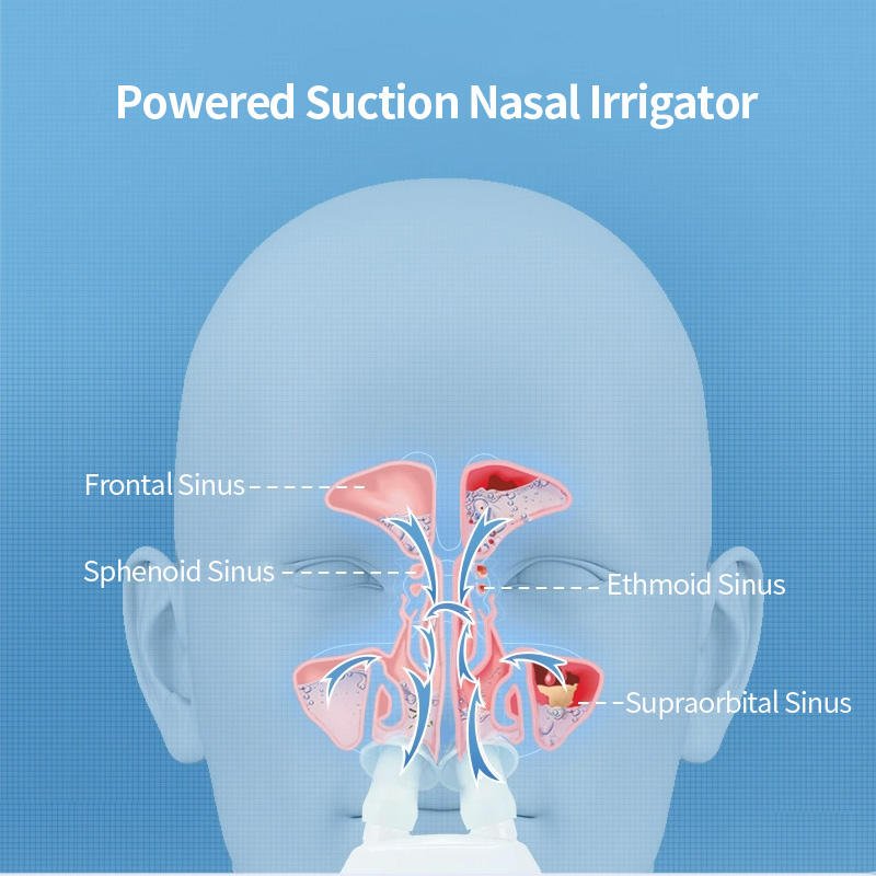 ELECTRIC NASAL IRRIGATOR